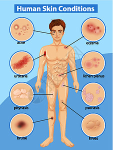 显示不同人体皮肤状况的图表图片