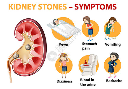 肾结石症状卡通风格 infographi肚子发烧血尿药品学习教育头晕插图框架背痛图片