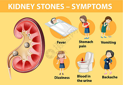 肾结石症状卡通风格 infographi病人艺术框架弱点教育疼痛药品呕吐绘画肚子背景图片