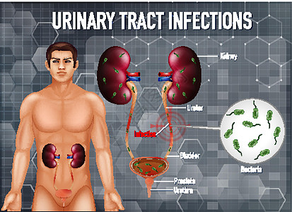 尿路感染的资料图解剖学微生物学信息科学海报刀片图表生物学器官生理图片
