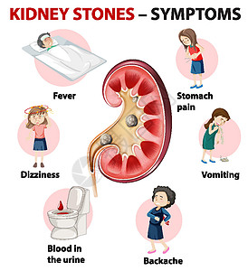 肾结石症状卡通风格 infographi呕吐药品头晕教育卡通片指示牌发烧弱点插图血尿图片