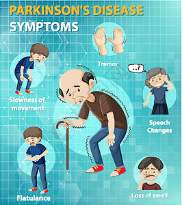 帕金森病症状信息图教育药品震颤老年插图疾病弱点医疗病人胀气图片