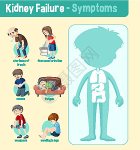 肾功能衰竭症状信息 Infographi肿胀病人卡通片药品疾病绘画图表症状指示牌剪贴图片