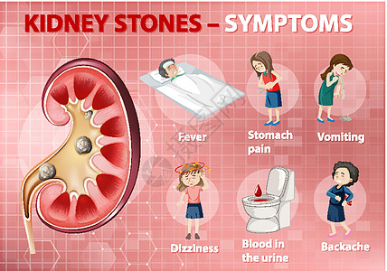 肾结石症状卡通风格 infographi药品图表插图教育病人弱点指示牌背痛发烧医生图片
