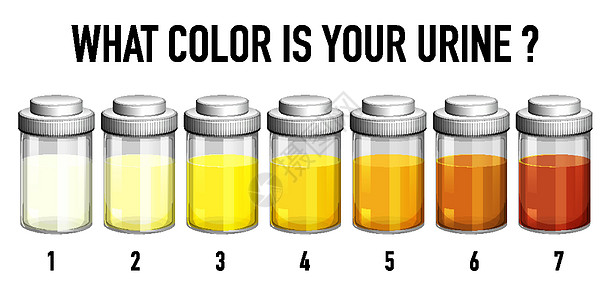 尿液色炭图解剪贴插图脱水液体实验室意义教育图表学习黑暗图片