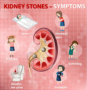 肾结石症状卡通风格 infographi卡通片学习艺术药品头晕疼痛绘画弱点图表框架图片
