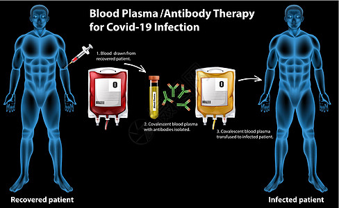 Covid19 感染的血浆抗体治疗信息图i微生物学指示牌症状科学疾病插图测试框架生理生物图片