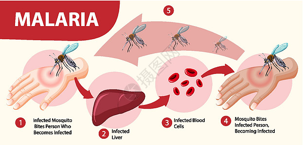 疟疾症状信息图表标识插图漏洞全世界寄生虫呕吐病人框架横幅疾病图片