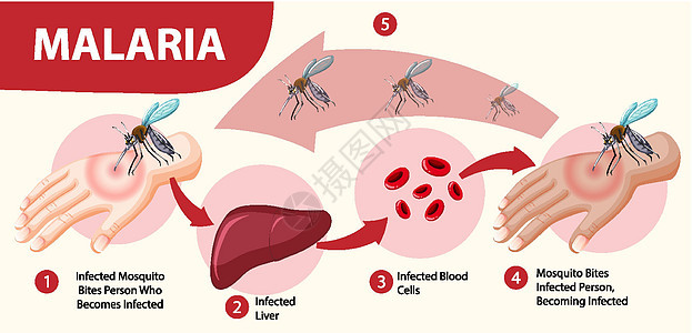 疟疾症状信息图表标识插图漏洞全世界寄生虫呕吐病人框架横幅疾病背景图片