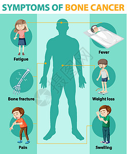 骨癌的医学信息图图片