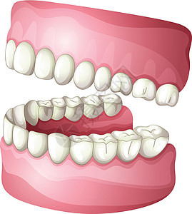 假记牙齿搪瓷假牙绘画下颌弓组织牙科器官牙龈假肢背景图片