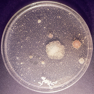 实验室中带有培养介质和霉菌的Petri瓷盘科学药品基质诊断棕色菌类危害病菌结垢疾病图片