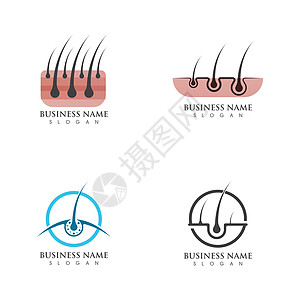 头发护理图标插图模板损害血清皮脂腺治疗男人头皮卵泡皮肤科皮肤蛋白图片