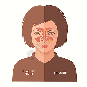 矢量鼻子 鼻窦解剖感染发烧喷嚏耳朵流感空腔药品解剖学呼吸科学图片