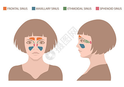 矢量鼻子 鼻窦解剖药品鼻音空腔白色呼吸发烧喷嚏男人科学感染图片