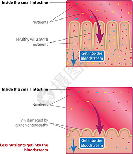 小肠吸收营养图片