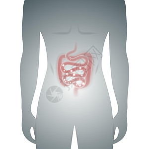 男性剪影与病态肠道医学载体它制作图案便秘器官通货膨胀身体冒号腹部息肉吸收养分胀气图片