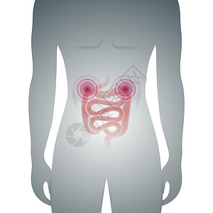 男性剪影与病态肠道医学载体它制作图案腹胀消化癌症腹泻胀气身体男人器官息肉便秘图片