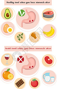 患有胃溃疡病的人健康 避免进食; 预防胃疾病; 医学概念; 矢量图解图片