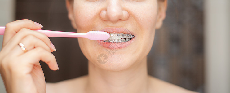 牙齿上戴牙套的女孩用牙刷刷牙摄影牙疼医生治疗牙膏打扫口腔科卫生凹痕成人图片