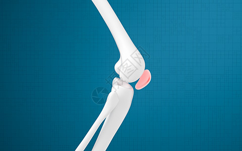 腿骨和膝盖损伤 3D感应外科生物学身体治疗关节渲染软骨疼痛骨科胫骨图片