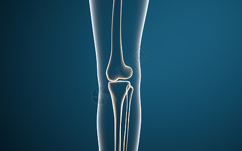腿骨和膝盖 3D感应外科白色疾病插图蓝色骨骼健康软骨手术渲染图片