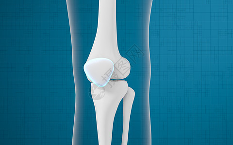 腿骨和膝盖 3D感应手术疾病胫骨插图渲染骨骼白色治疗身体外科图片