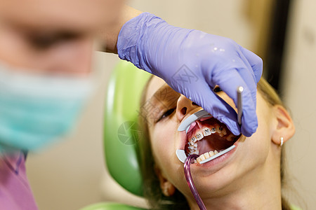 之后 我要有一个光明的笑容女孩假牙牙齿牙科病人卫生药品保健诊所塑胶图片