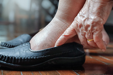 穿鞋的老年妇女肿胀的脚皮革疾病祖父母糖尿病老化母亲保健医生手指皮肤图片