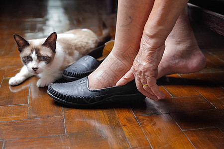 穿鞋的老年妇女肿胀的脚皮肤老化糖尿病宠物脚肿卫生退休保健疾病拖鞋图片