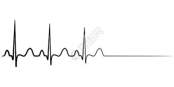 死亡情况韵律光束援助展示心电图心脏病学诊断监视技术背景图片