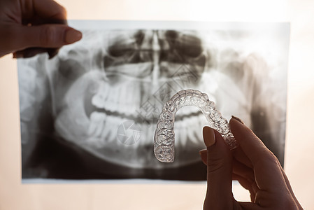 女性用透明口腔保护的手 以纠正咬伤和下巴X光检查 整牙师拥有矫形师的设备射线口腔科牙科牙医医生矫正仪器固定器塑料卫生图片