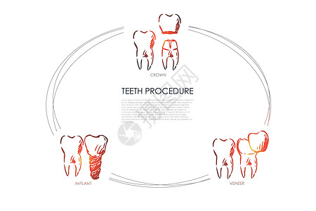 牙齿手术矢量概念 se诊所插图健康口服检查保健钻头口腔科矫正草图图片