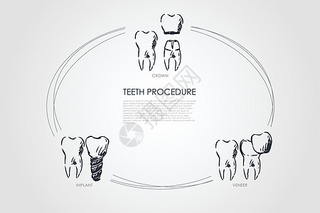 牙齿手术矢量概念 se工具卫生插图牙科假牙医院程序健康口腔科铣削图片