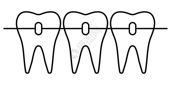 牙齿矫正牙齿对齐美丽的微笑金属牙医牙科支撑卡通片卫生搪瓷关心结盟牙疼图片