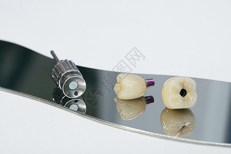 单石螺丝保留了植入的冠 一个螺丝和一个手动钥匙 用来与皇冠乱搞 掌上电脑制品工具解剖学陶瓷假牙矫正塑料植入物身体药品图片