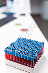 在生物化学检验期间收集血样的真空管 用于采集血液样本的真空管医院感染临床诊所生物学物质液体疾病药店技术图片