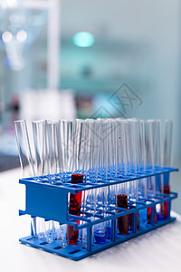 化学分子检查时血液站在桌上的医用试管临床药店生物学管子玻璃疫苗化学家考试诊断样本图片