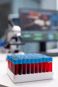 在生物化学检验期间收集血样的真空管 用于采集血液样本的真空管考试生物学疫苗医院药品真空血管化学家感染测试图片
