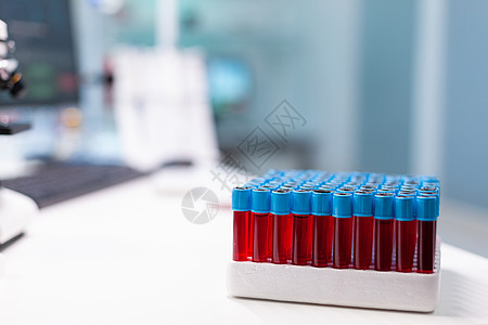 在药物检验期间 有血样的医药卫生真空剂放在桌上 药检期间图片