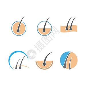 头发护理日志治疗皮肤科学诊所标识生长医院皮肤科卵泡脱毛图片