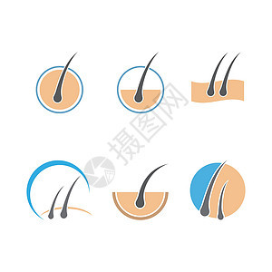 头发护理日志治疗皮肤科学诊所标识生长医院皮肤科卵泡脱毛图片