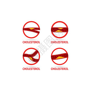 胆固醇斑块徽标图标的矢量控制动脉插图饮食攻击动脉硬化疾病标识糖尿病医生图片