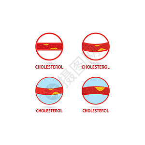 胆固醇斑块徽标图标的矢量动脉硬化饮食攻击食物压力动脉安全标识血小板高血压图片