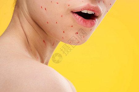 女性面对近身红点皮肤皮疹物质头发产品厌恶爸爸面具青春痘药品疾病温泉图片