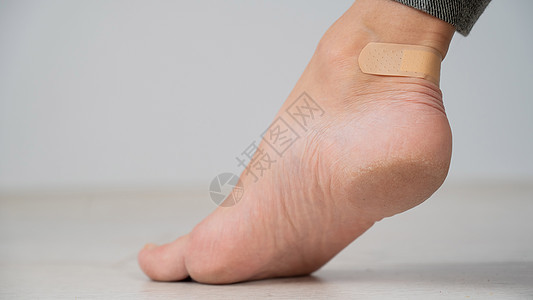 一个女人用石膏封住她腿上的玉米 女孩用不舒服的鞋子擦她的腿情况磁带保健卫生伤害水疱赤脚伤口药品皮肤图片