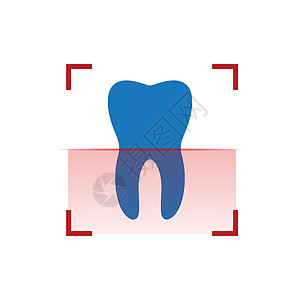 人类牙齿扫描 红色扫描仪或 x 射线 种植牙 治疗扫描概念 在白色背景上隔离的矢量图背景图片
