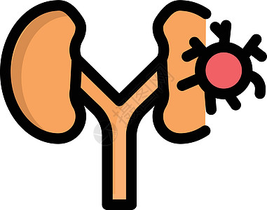 肾卫生手术膀胱诊所石头囊肿医疗科学肾脏器官图片