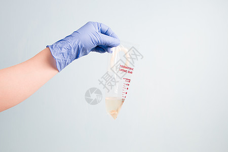 蓝色一次性医用橡胶手套小儿手拿着空尿袋 儿童尿液收集袋 蓝色背景 复印空间医院药品洗手间服务微生物学国民危害护士治疗实验室图片