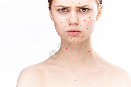 脸部有红点的女子 皮肤问题皮肤病不满意伤口学生疙瘩面具疾病青春痘悲伤爸爸温泉鳗鱼图片